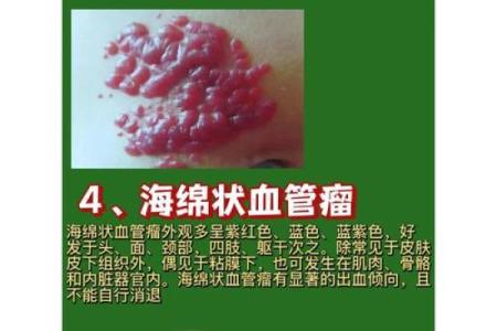 风水学上胎记中的有说明什么
