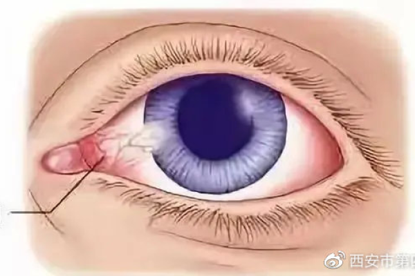 眼睛黑眼珠子多算命