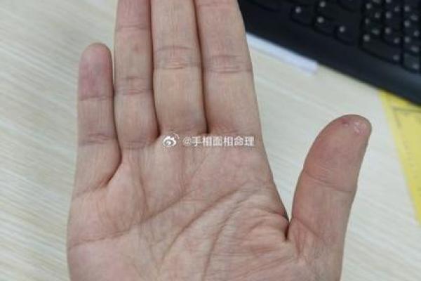 手相风水：命运线中间断开象征什么意义