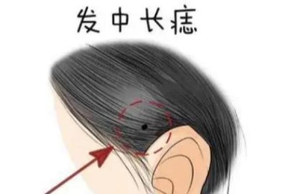 痣长在脸上哪个位置好 有福气之人财神眷顾