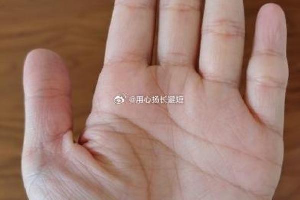 算命的说，手腕上有这样的纹路，一定会破财！