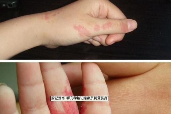 据脖子上胎记算命，有什么说法