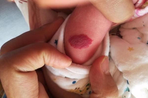 如何通过自己的胎记算命看自己的一生-