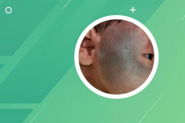 如何通过自己的胎记算命看自己的一生-