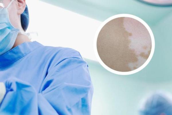 屁股有白斑风水 屁股有白斑风水