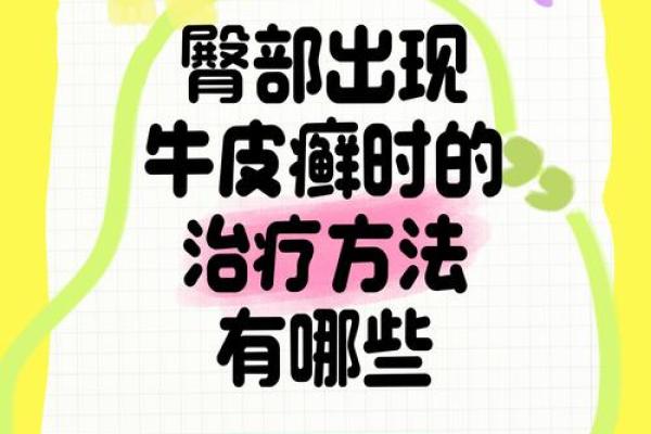 屁股有白斑风水 屁股有白斑风水