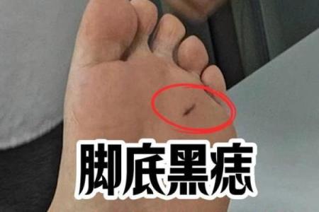 脚底的胎记算命分析