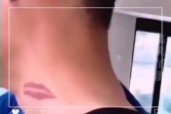 脖子上不同位置胎记算命 脖子上不同位置胎记算命