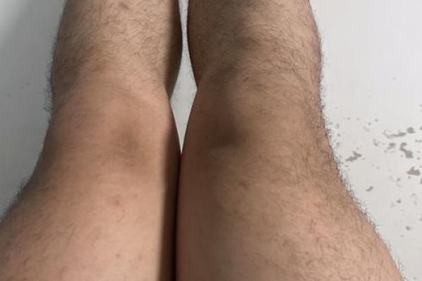 腿上有毛算命 腿上有毛算命