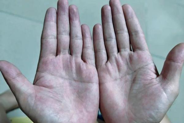 断掌男的手相算命图解 断掌的男人坚强有韧性 断掌男的手相算命图解 断掌的男人坚强有韧性