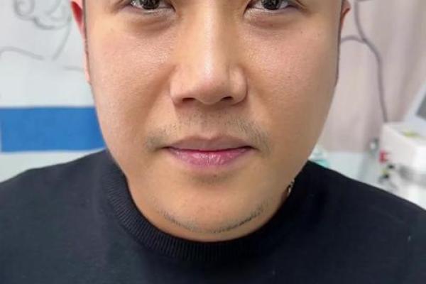 八字眉的男人能嫁吗 八字眉怎么改善 八字眉的男人能嫁吗 八字眉怎么改善