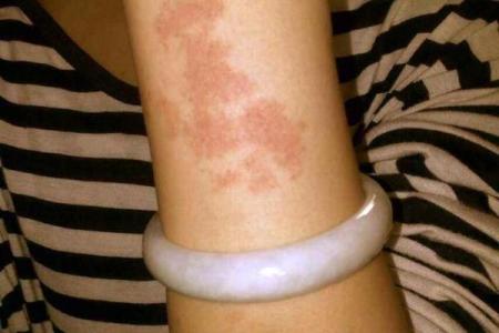 胎记算命胎记的位置与命运