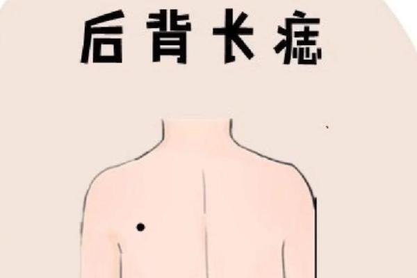 女人背部痣相图解算命 女人背部痣相图解算命