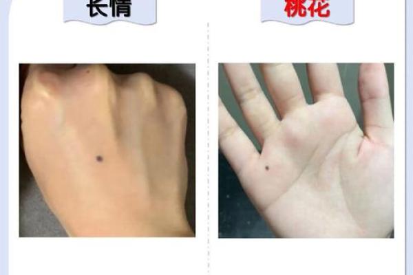 背上的痣图解算命