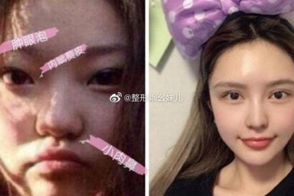 整容的八字 整容的八字