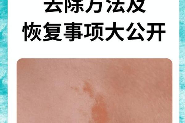 胎记算命:从胎记看运势 胎记算命:从胎记看运势