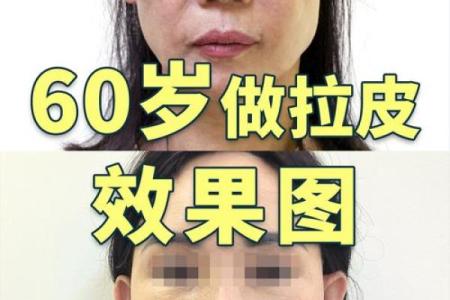 怎么消除八字纹