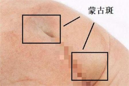 屁股有胎记算命分析