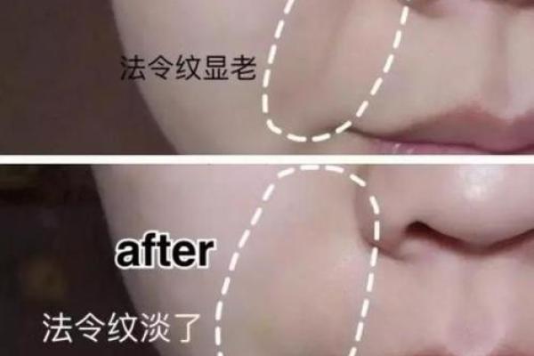 八字纹怎么去除