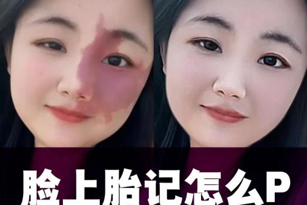 看脸上胎记如何算命