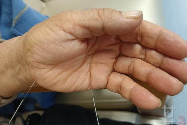 八字悬针 八字悬针