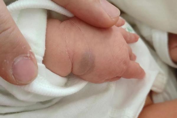 男婴眉心长“月牙”胎记，母亲带他算命后神秘失踪，至今下落不明