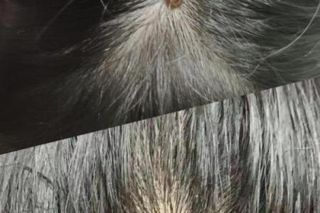 头上长瘊子好不好算命